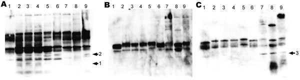 Western blot analysis of 10 μL of bacterial suspension (1.8 × 1010 CFU/mL) loaded to a gel and subjected to electrophoresis. The proteins were transferred onto a nitrocellulose membrane, which was incubated in mouse or human serum as described in Materials and Methods. Serum samples used were convalescent-phase serum of the Bordetella petrii–infected patient (A), a pool of serum specimens from B. pertussis–infected patients (B), and a pool of serum specimens from B. bronchiseptica–infected patie