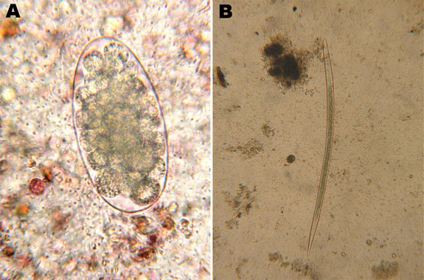 Trichostrongylus colubriformis nematode isolated from feces of a 47-year-old woman, France. A) Egg (length 89 µm) isolated by using direct examination (original magnification ×200). B) Third-stage larvae (length 740 µm, 16 intestinal cells, length of distal part of the sheath &lt;40 µm) isolated by using fecal culture (original magnification ×50).