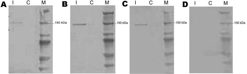 Results of serologic analysis by Western blot of serum specimens from patient 2, a 22-month-old girl with acute necrotizing ancephalopathy. Three serum specimens from patient 2, harvested at 6 (A), 13 (B), and 19 (C) days after onset of symptoms, and a serum specimen from a healthy donor (D) were incubated with reovirus MRV2Tou05–infected and –noninfected BGM cells. I, infected; C, noninfected; M, molecular weight markers (Precision Plus protein standards).