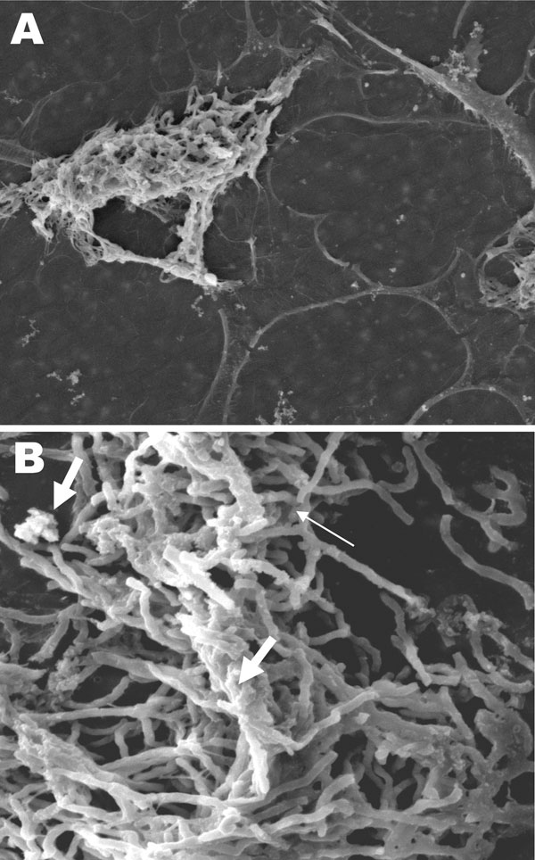 Scanning electron microscopy of Nocardia spp. biofilm on silicone central venous catheters. A) N. nova complex (disseminated Nocardia bacteremia) on the surface, showing heavy biofilm matrix covering filamentous cells. B) N. nova complex (definite central line–associated bloodstream infection) showing network of filamentous (thin arrow), partially covered with opaque biofilm matrix (thick arrows). Original magnifications ×2,500.