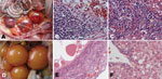 Thumbnail of Pathologic changes in diseased Pekin ducks. A) Ovary with hyperemia, hemorrhage, and distortion. B) Ovary with hemorrhage (gold arrow), macrophage and lymphocyte infiltration and hyperplasia (green arrow). C) Liver with interstitial inflammation in the portal area (gold arrow). D and E) Ovaries from healthy ducks. F) Liver from healthy duck. A, C) Original magnification ×40; B, C, E, F) scale bars = 90 μm.