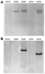 Thumbnail of Plasmidic profile of the enteroaggregative Escherichia coli strains (A) and Southern blotting of the blaCTX-M-15 gene (B).
