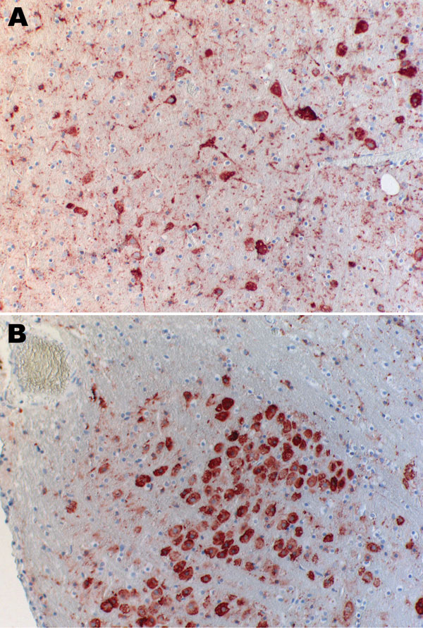 Immunohistochemical analysis of brain of Natterer’s bat for lyssavirus antigen by using the avidin biotin complex method. A) Cerebrum showing a large number of neurons. Cytoplasmic granular-to-diffuse staining for rabies antigen is visible in the perikarya and neuronal processus. B) Medulla and neurons of the nucleus funiculi lateralis showing strong cytoplasmic staining for rabies antigen. Original magnifications ×20.