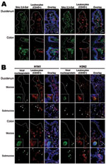 Thumbnail of Intestinal distribution of influenza virus receptors and in vitro binding of inactivated seasonal influenza A (H1N1) and A (H3N2) viruses to human duodenal and colonic tissues. Images in the panels labeled Overlay show the green, red, and blue (nuclei counterstain) color channels in the same view. Dotted lines outline basal lining of intestinal epithelium. Arrowheads denote virus-bound cells. Scale bars = 20 µm. A) Double immunofluorescence staining showing that human-like influenza