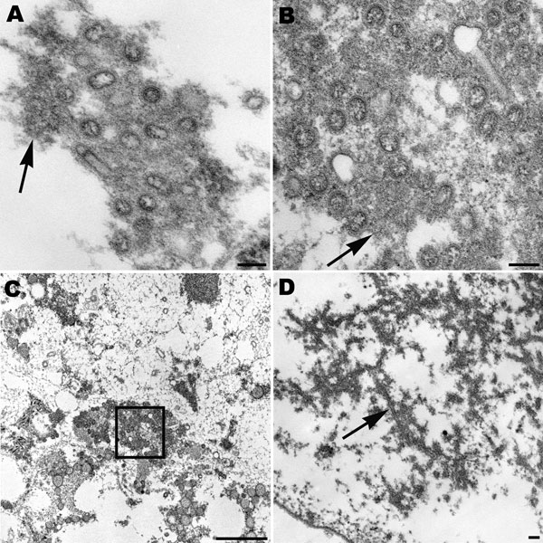 Spherical and ovoid extracellular pandemic (H1N1) 2009 virus particles in human lung tissue found in the alveolar space (A) and in a submucosal gland (B). Nucleocapsids and surface projections are visible on some virions. Note the dense material (arrows) associated with the particles. Scale bars = 100 nm. C) Low-power magnification of the aggregation of virus particles seen in panel B, showing virions (box) in the mucus of the submucosal gland. Scale bar = 1 μm. D) Dense tubules (arrow) found in