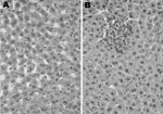 Thumbnail of Histologic analysis of infection with rat hepatitis E virus, Los Angeles, California, USA. Hematoxylin and eosin–stained sections of liver from a healthy rat (A) and a rat acutely infected with rat HEV (B). Original magnification ×200.