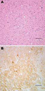 Thumbnail of Histopathologic analysis of transgenic mouse expressing bovine prion protein (PrP) gene inoculated with bovine spongiform encephalopathy agent. Spongiform degeneration in the thalamus (A), adjacent section showing PrP immunopositivity (B). Panel A was stained with hematoxylin and eosin, panel B was immunostained with PrP antibody 6D11. Scale bars = 100 μm.