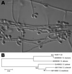 Thumbnail of A) Photomicrograph of sympodial and sessile conidia of Sporothrix mexicana obtained by using a transmitted differential interference contrast microscope. The isolate was obtained from a patient in Portugal in 2009 and archived in the Micoteca da Universidade do Minho (MUM) under accession no. MUM 11.02. Scale bar = 10 μm. B) Neighbor-joining tree showing relatedness of MUM 11.02 isolate with other species of the S. schenckii complex. The percentage of replicate trees in which the as