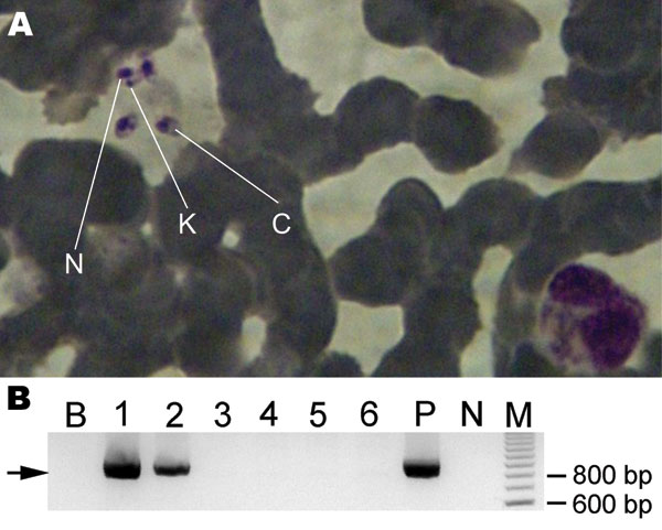 Case of autochthonous human visceral leishmaniasis in a 44-year-old man, identified by parasitologic diagnosis and molecular detection of the causative species, Salta, Argentina. A) Leishmania amastigotes in a bone marrow smear. N, nucleus; K, kinetoplast; C, cytoplasm (Giemsa stained, original magnification ×1,000). B) Amplification by nested PCR of cytochrome b gene of Leishmania infantum. Arrow indicates amplified fragment of ≈850 bp. Lane B, blank control; lanes 1 and 2, patient bone marrow 