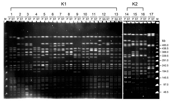 Pulsed-field gel electrophoresis of randomly selected isolates of Klebsiella pneumoniae from 17 patients with liver abscess, Taiwan, January 2009–December 2010. DNA fragments were subjected to electrophoresis after digestion with XbaI. Lanes 1–13, serotype K1 isolates; lanes 14–16, serotype K2 isolates; lane 17, serotype non-K1/K2 isolates. M, molecular mass marker; P, liver aspirate; ST, stool; SA, saliva.