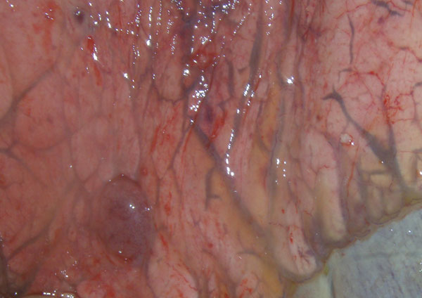 Dilation of lymphatic vessels and ventral lung lobe margins of horse 3 experimentally infected with Hendra virus, Australia. Original magnification ×10.