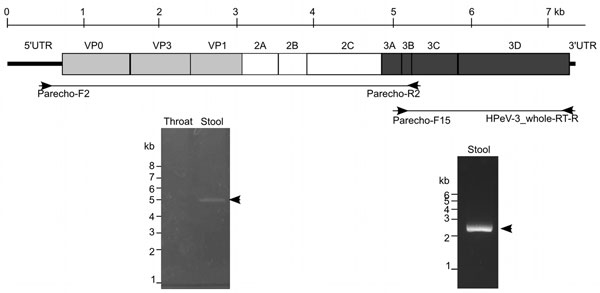 Schematic representation of the human parechovirus 3 (HPeV3) genome sequence and coding polyprotein. Reverse transcription PCR results are shown below the sequence. VP, viral protein; UTR, untranslated region.