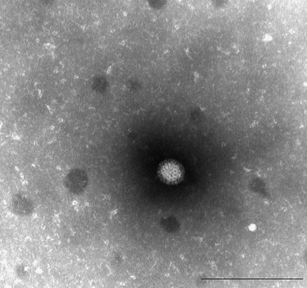 Electron micrograph of orthoreovirus HK50842/10. Scale bar = 200 nm.