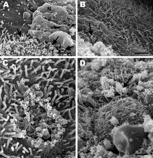 Scanning electron micrographs of the lung from a 2-year-old ferret that died of acute dyspnea, showing A) marked loss of cilia with multifocal degenerative changes characterized by bulbous swelling of cilia (arrows) and necrosis of bronchial epithelial cells (N) (scale bar = 1 µm); B) marked loss of cilia and numerous pleomorphic mycoplasma-like organisms diffusely attached to the mucosal surface (arrow) (scale bar = 1.25 µm); C) focal area of cilia loss and cell membrane damage with mycoplasma-