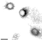 Thumbnail of Electron micrographs of purified DRV-TH11 isolate particles showing the features of orthoreovirus. Original magnification ×100,000. Scale bar = 100 nm.