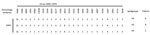 Thumbnail of Spoligotype and 24-loci MIRU-VNTR typing results for Mycobacterium tuberculosis complex isolates recovered from 3 patients with multidrug-resistant tuberculosis (TB). Patient A (index case-patient), Burma-born man with TB, incarcerated in Singapore correctional facility; patient B, Singapore-born man with HIV infection and TB, who transported prisoners in Singapore; patient C, Singapore-born man with HIV infection and TB, who shared cell with patient A. MIRU-VNTR, mycobacterial inte