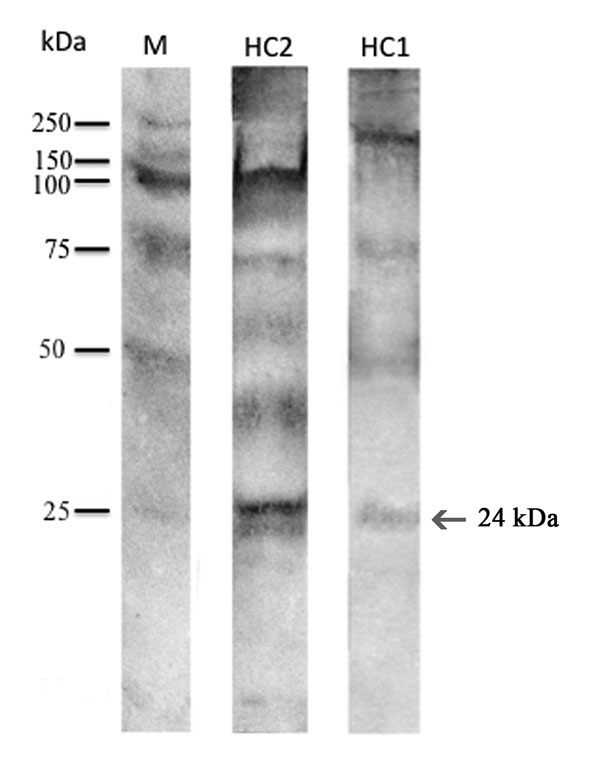 Western blot reaction of the sera from patients HuC1 and HuC2 from Italy showing allergic reaction against Anisakis pegreffii antigens and allergens. M indicates molecular marker; arrow indicates the reaction at 24 kDa (Ani s1). IgE determination was performed with alkaline phosphatase conjugates obtained from goat anti-human IgE. Antigen-antibody binding was visualized by the alkaline phosphatase 5-bromo-4-chloro-3-indolyl phosphate p-nitroblue tetrazolium chloride system until bands appeared. 