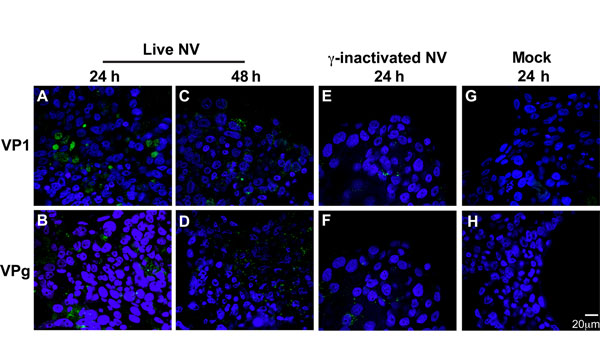 No evidence of productive Norwalk virus (NV) replication in 3-dimensional INT-407 aggregates by confocal microscopy analysis of viral proteins. Three-dimensional INT-407 aggregates 24 h post inocupation (hpi) (panels A, B) and 48 hpi (panels C, D) with live NV, 24 hpi with inactivated NV (panels E, F), or phosphate-buffered saline alone (positive controls) (panels G, H). Aggregates were stained for viral capsid protein 1 (VP1) (panels A, C, E, G) or nonstructural protein VPg (panels B, D, F, H).