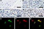 Thumbnail of Expression of large T-antigen (LT-Ag) and p53 within a subset of tumors. A) Control, immunohistochemical analysis of frontal lobe of normal raccoon brain tissue. Astrocytes in this image and throughout the section were not immunoreactive for LT-Ag. Original magnification ×40. B, C) Immunohistochemical analysis for raccoon no. 2 (Rac2) and Rac3. LT-Ag is expressed within the nuclei of a subset of neoplastic astrocytes in 2 independent tumors. Original magnification ×40. D) Immunohist