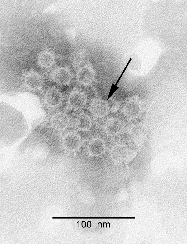 Electron microscopy of negative-stained orthohepadnavirus particles from a bat (arrow). Clumps of Australia antigen–like particles are seen.