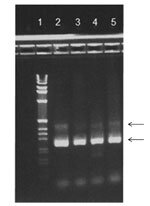 Thumbnail of Agarose gel stained with ethidium bromide. Reverse transcription PCR products from 4 patients are shown in lanes 2–5 and 1-kb DNA Ladder (Life Technologies Corp., Carlsbad, CA, USA) in lane 1. Arrows indicate 2 bands corresponding to ≈250 and ≈400 bp.