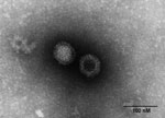 Thumbnail of Electron micrograph of orthoreovirus MRV1-HB-A.
