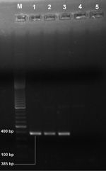Thumbnail of Electrophoretogram of Leishmania donovani kinetoplast DNA-specific PCR products (385 bp) isolated from patients with suspected post–kala-azar dermal leishmaniasis, Assam, India. Lane M, 100-bp DNA ladder; lanes 1–4, suspected post–kala-azar dermal leishmaniasis case-patient; lane 5, negative control. PCR products were visualized by staining with ethidium bromide after electrophoresis in 1% agarose gel.