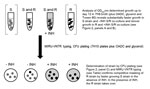 Thumbnail of Mycobacterium tuberculosis co-culture competition experiment in a study of the amplification of multidrug resistance induced by first-line treatment of a mixed M. tuberculosis infection. The results suggest competitive advantages in vitro, which may account for patient strain phenotype in vivo. S, drug sensitive; R, drug resistant; OADC, oleic acid, albumin, dextrose, catalase growth supplement; OD600, optical density read at 600 nm; −INH, without isoniazid; +INH, with INH; MIRU-VNT