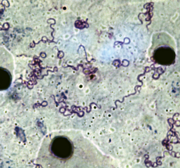Thick smear of mouse blood showing Borrelia crocidurae isolate 02–03. Giemsa stain; magnification x900.