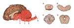 Thumbnail of Yearling steer with encephalomyelitis. Midsagittal section of brain and multiple transverse sections of cerebellum, brainstem, and spinal cord depicting the location and severity of microscopic lesions. Midsagittal section of the brain: red highlight indicates areas of the central nervous system affected, numbers indicate severity of the lesions (1 = least severe; 2 = more severe; 3 = most severe), and red lines (A, B, C, D) indicate the levels where transverse sections were cut. A,