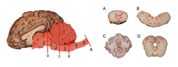 Yearling steer with encephalomyelitis. Midsagittal section of brain and multiple transverse sections of cerebellum, brainstem, and spinal cord depicting the location and severity of microscopic lesions. Midsagittal section of the brain: red highlight indicates areas of the central nervous system affected, numbers indicate severity of the lesions (1 = least severe; 2 = more severe; 3 = most severe), and red lines (A, B, C, D) indicate the levels where transverse sections were cut. A, spinal cord.