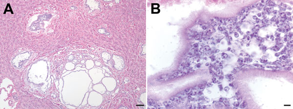Microscopic images of liver sections from a Bornean orangutan fatally infected with Versteria metacestodes. Images of liver sections stained with hematoxylin and eosin (H&amp;E) stain were captured at 10× magnification (A; scale bar = 30 μm) and 100× magnification; B; scale bar = 5 μm). Large numbers of parasite cells can be seen within well-defined cystic structures separated from the surrounding host tissue by clearly visible membranes.