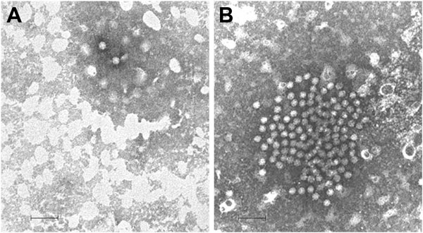 Electron microscopy images of astrovirus-like particles in fecal samples from 2 patients in Italy: A) strain ITA/2007/PR326, from a 4-year-old child hospitalized in January 2007; and B) strain ITA/2008/PR3147, from a 14-month-old child hospitalized in November 2008. The viral particles are ≈28–30 nm in diameter. Scale bars represent 100 nm.