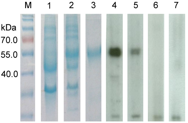 Sodium dodecyl sulfate-polyacrylamide gel electrophoresis and Western blot analysis of a novel coronavirus, dromedary camel coronavirus UAE-HKU23, discovered in dromedaries of the Middle East, 2013.Nucleocapsid protein was expressed in Escherichia coli. M, protein molecular-mass marker; kDa, kilodaltons. Lanes: 1, non-induced crude E. coli cell lysate; 2, induced crude E. coli cell lysate of DcCoV UAE-HKU23 nucleocapsid protein; 3, purified recombinant DcCoV UAE-HKU23 nucleocapsid protein; 4, dr