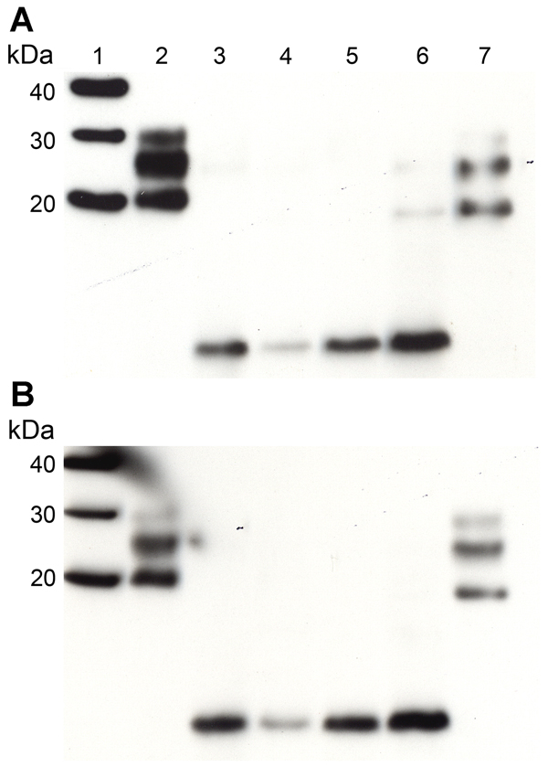 Western blot analysis of PrPres in extracts of frontal cortex tissue prepared from postmortem samples from 2 persons with sCJD (subtypes MM1 and VV2) and the 3 persons with VPSPr whose brain samples were used for experimental transmission studies in transgenic mice (patients NL-VV, UK-VV, and UK-MV). Extracts from another patient who had VPSPr of UK origin (codon 129VV genotype) was also included on the blot (lane 6). Duplicate blots were probed with the following monoclonal antibodies: Anti-Pri