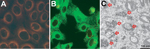 Thumbnail of Isolation of severe fever with thrombocytopenia syndrome virus (SFTSV) from case-patients, South Korea, 2013. A, B) Indirect immunofluorescent features of Vero E6 cells primed with SFTSV N protein monoclonal antibody and reacted with fluoresce in isothiocyanateconjugated anti-mouse IgG. B) Transmission electron microscopy image of Vero E6 cells infected with SFTSV. Scale bar indicates 500 nm.