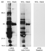 Thumbnail of Immunoblot analysis of serum samples from 2 animals for Borrelia hermsi, Bitterroot Valley, Montana, USA. Samples were tested with B. hermsii whole cell lysates (WCL) (left lanes) and purified recombinant glycerophosphodiester phosphodiesterase (rGlpQ) (right lanes). +#804 Corvallis, seropositive sample from yellow-pine chipmunk (Tamias amoenus) trapped on patient’s property; +#760 Lake Como, seropositive sample from red-tailed chipmunk (T. ruficaudus) trapped at Lake Como, Montana;