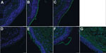 Thumbnail of Interaction of hemagglutinin (HA) of H3-P99 (panels B and E) and H10-JD346 (panels C, F, and G) isolates of influenza A(H10N8) viruses with human trachea. Sections from 2 persons are shown (A–C and D–G). A and D, negative control staining (secondary antibody without HA). Blue indicates nuclei stained with 4',6-diamidino-2-phenylindole; green indicates HA binding. Scale bars indicate 25 μm. 