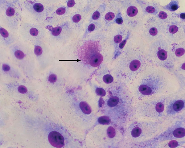 Bacterial cytoplasmic inclusions (arrow) in Vero cell cultures 72 h postinoculation with supernatant from homogenates of white spot lesion biopsies of adult A. intermedius bats in Mexico by using Diff–Quick stain (VWR International, Briare, France). Original magnification ×700.