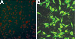 Thumbnail of Immunofluorescence assay detection of severe fever with thrombocytopenia syndrome virus (SFTSV) antibodies in serum samples from mice fed by SFTSV-infected ticks. A) Normal mouse serum (negative control) reacting with SFTSV-infected DH82 cells; B) infected mouse serum (1:128, mouse no. 4) reacting with SFTSV-infected DH82 cells.