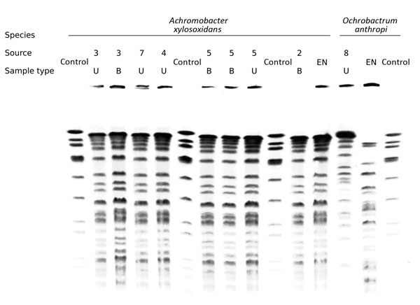 Pulsed-field gel electrophoresis of clinical and environmental strains of Achromobacter xylosoxidans and Ochrobactrum anthropi infections in patients after undergoing prostate biopsies at Hôpital Édouard Herriot, Lyon, France. Patient numbers match those in Table 1. EN, environmental; B, blood; U, urine; control, reference sample (i.e., a load of standard DNA used to calibrate the gel and correct for deformations in the migration trajectory, as described in Methods).