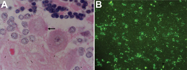 Negri bodies and lyssavirus antigens in brain tissue from an Indian flying fox, Sri Lanka. A) Degenerate Purkinje’s cell with an eosinophilic, intracytoplasmic inclusion body and a Negri body (arrow). Hematoxylin and eosin stain, original magnification ×1,000. B) Green fluorescence indicative of lyssavirus nucleoprotein in a brain smear subjected to a direct fluorescence antibody test with fluorescein isothiocyanate–conjugated monoclonal antibody. Original magnification ×100.