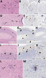 Thumbnail of Results of histopathologic testing of central nervous system tissues from 2 symptomatic newly weaned pigs from a farm in Hungary. Sections of the cervical spinal cord (A–E), cerebellum (F–J), and cortex (L, M) from the index animal (GD-1) and the brainstem (K) from an additional affected stage 1 animal (GD-11). A, D, F, I, L) Hematoxylin and eosin stain. Gliosis (black arrows) is multifocal within the gray matter (panels A, D) and in the molecular layers (panels F, I, L and M). Neur