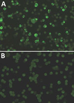 Thumbnail of Immunofluorescence assay results of infected monkey serum A) characterized by granular staining pattern of HeLa cells and B) noninfected monkey serum. Original magnification ×400.