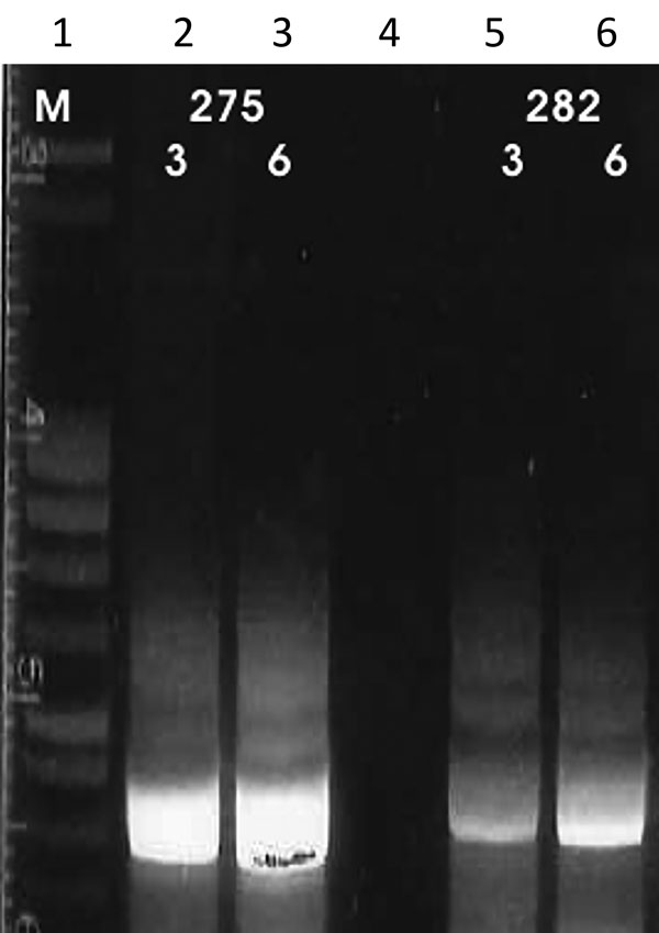Results of cpb-EF PCR (14,15) on patient samples identified as belonging to the Leishmania infantum/donovani complex in study of leishmaniasis control programs in northern Syria. Lane 1, step marker; lanes 2 and 3, L. donovani strain 275 with 3 and 6 μL of DNA, respectively; lane 4, negative control; lanes 5 and 6, L. infantum strain 282 with 3 and 6 μL of DNA, respectively.