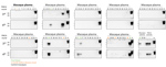 Thumbnail of PMCA analysis of deidentified plasma samples from macaques infected with macaque-adapted vCJD and control macaques. Plasma samples from 2 infected (M1 and M3) and 28 control macaques were sarkosyl precipitated and analyzed by 4 rounds of PMCA. This panel of samples included 6 plasma samples collected at the final bleed (M1, #16, #75, #76 ; M3: #66, #93, #94), 6 plasma samples collected 1 month before disease onset (M1, #72, #84, #92 ; M3: #3, #61, #87), and 81 plasma samples from co