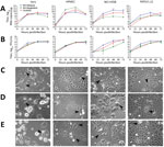 Thumbnail of Replication of NiVs CSUR381 (Cambodia 2003 isolate), UMMC1 (NiV-Malaysia isolate), and SPB200401066 (NiV-Bangladesh isolate) in Vero, HPMEC, NCI-H358 (human bronchioalveolar cells), and PATGV1.12 (bat cells). A) Real-time reverse transcription PCR titer. Cells were infected at a multiplicity of infection of 0.3, and the production of the nucleocapsid gene was measured. Significance was measured by 2-way analysis of variance. B) Kinetics of infectious virus particle production in sup