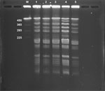 Pulsed-field gel electrophoresis patterns of restricted chromosomal DNA from Bacillus subtilis variant natto isolated from a case of bacteremia from gastrointestinal perforation after natto ingestion, Japan. B. subtilis strains were digested in Sfil enzyme. Lane M, CHEF DNA size marker (Bio-Rad, https://www.bio-rad.com) of Saccharomyces cerevisiae; lane 1, sample from blood; lane 2, sample from pus; lane 3, sample from natto brand A; lane 4, sample from natto brand B; lane 5, sample from natto brand C. Numbers at left indicate kilobases. 