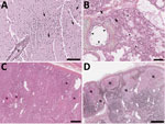 Histology section of thawed, formalin-fixed tissues from harbor seals (Phoca vitulina) infected by highly pathogenic avian influenza A(H5N1) virus in the St. Lawrence Estuary, Quebec, Canada, 2022. Hematoxylin phloxine saffron stain. A) Brain tissue from a young (<1 year old) female seal. The Virchow-Robin space around a vessel (V) is infiltrated by numerous layers of polymorphonuclear cells. Several neurons have a condensed hyperacidophilic cytoplasm indicative of necrosis and are often associated with satellitosis (arrows). A focally extensive infiltration of the neuropil by neutrophils and glial cells is also present. Scale bar indicates 100 µm. B) Lung from a young (<1 year old) female seal. The alveolar (A) and vascular (arrow) lumens contain numerous, often degenerate, polymorphonuclear cells. The alveolar walls are infiltrated by numerous inflammatory cells composed of neutrophils and mononuclear cells. The epithelial cells bordering the small bronchi are often necrotic. Scale bar indicates 100 µm. C) Adrenal gland of an adult female seal. Multifocal foci of necrosis are present in the cortical zone (N). Scale bar indicates 300 µm. D) Lymph node from an adult female seal. Marked multifocal to coalescing necrosis of the lymphoid tissues in the cortical region are noted (N). Scale bar indicates 1 mm.