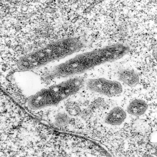 Transmission electron micrograph of the ELB agent in XTC-2 cells. The rickettsia are free in the cytoplasm and surrounded by an electron transparent halo. Original magnification X 30,000.